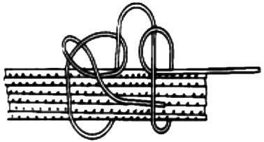 起始線節(jié)的打結 起始線節(jié)的打結