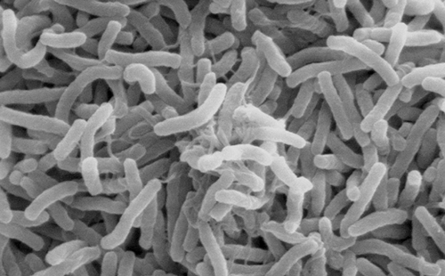 顯微鏡下的霍亂弧菌 顯微鏡下的霍亂弧菌